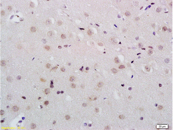 KDM5B Antibody in Immunohistochemistry (Paraffin) (IHC (P))