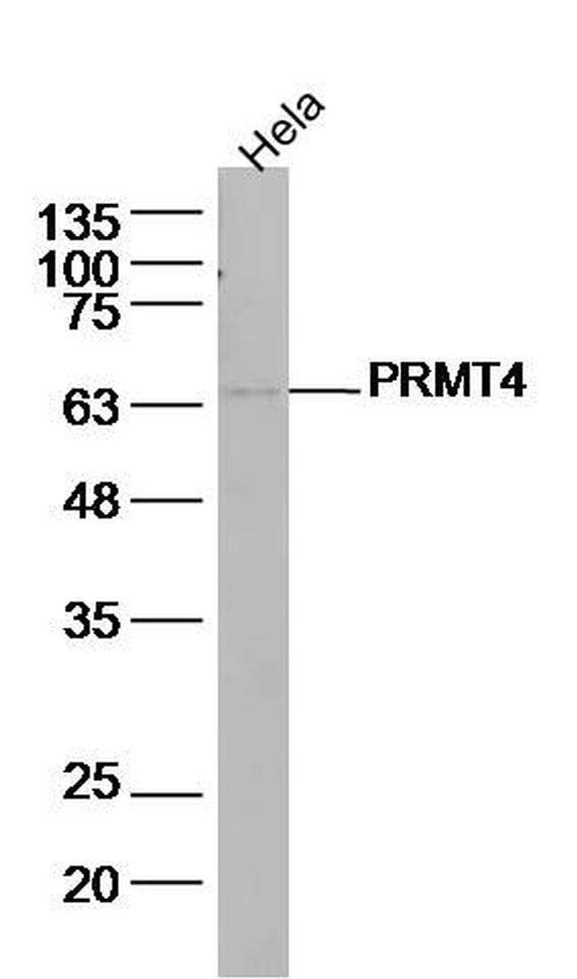 PRMT4 Antibody in Western Blot (WB)