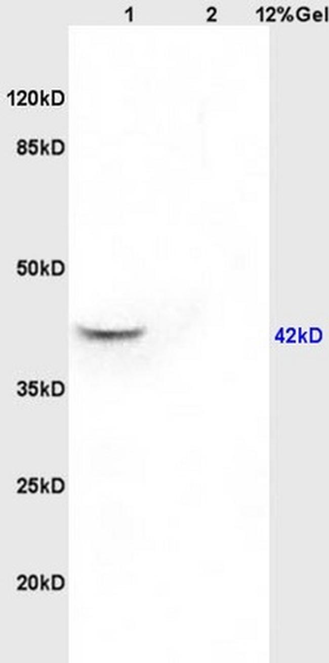 GNAQ Antibody in Western Blot (WB)