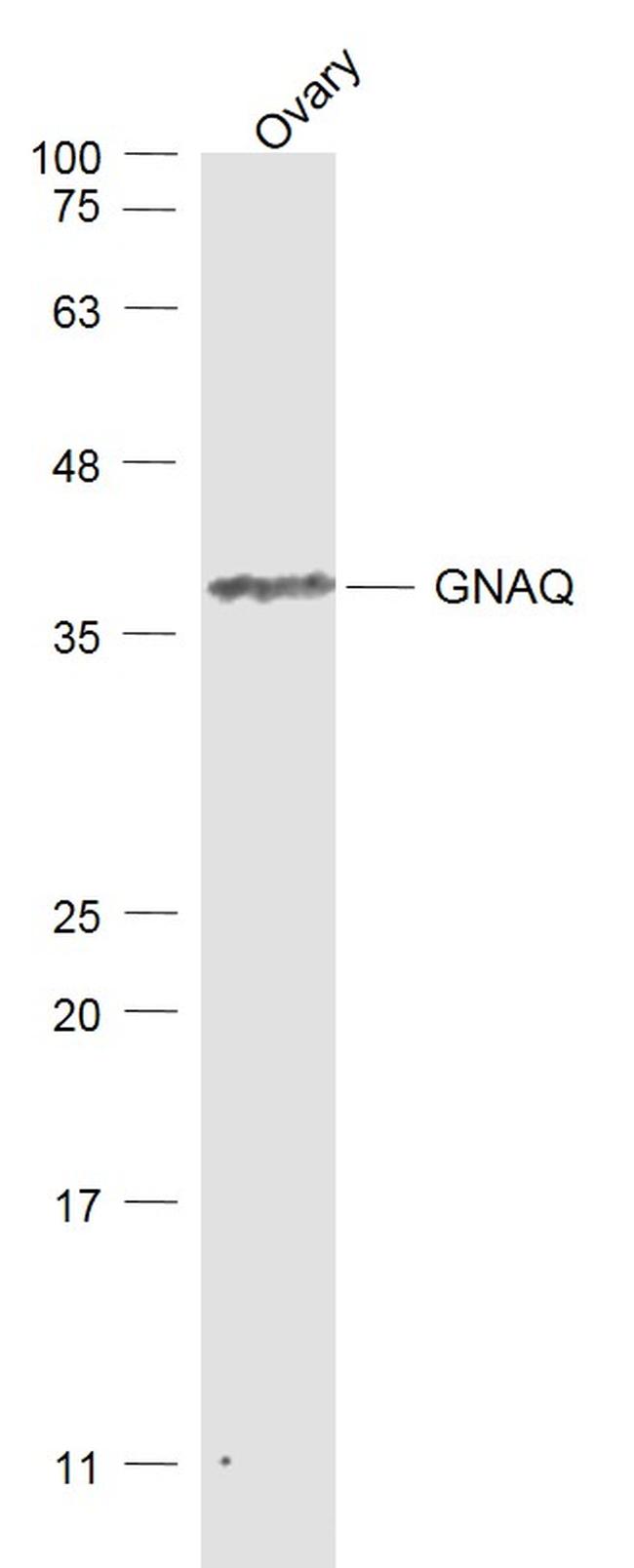 GNAQ Antibody in Western Blot (WB)