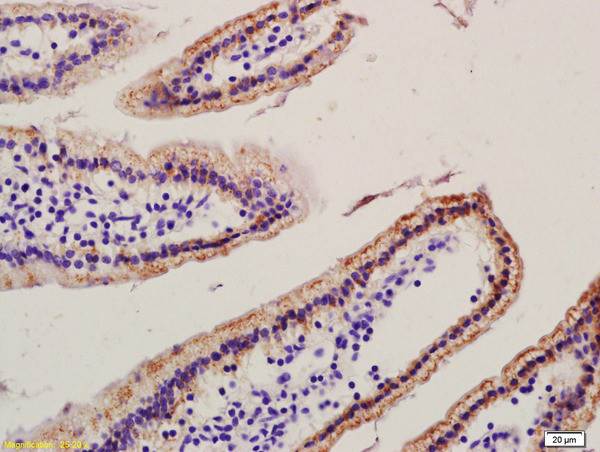 RAC1+RAC2 Antibody in Immunohistochemistry (Paraffin) (IHC (P))