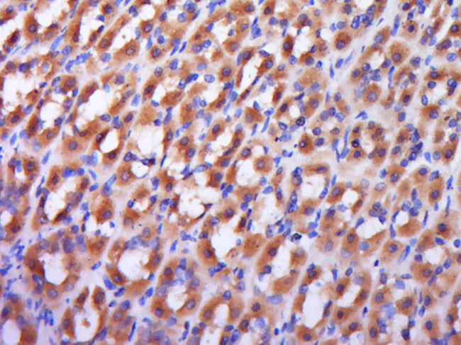 RAB9 Antibody in Immunohistochemistry (Paraffin) (IHC (P))