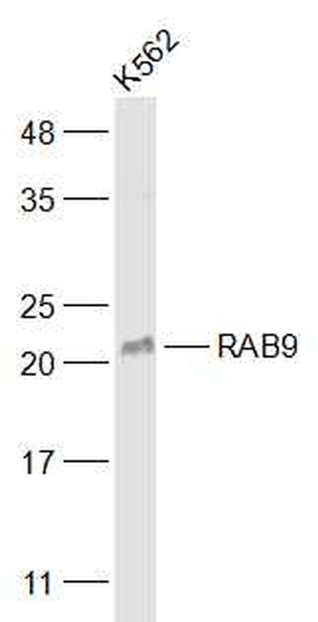 RAB9 Antibody in Western Blot (WB)