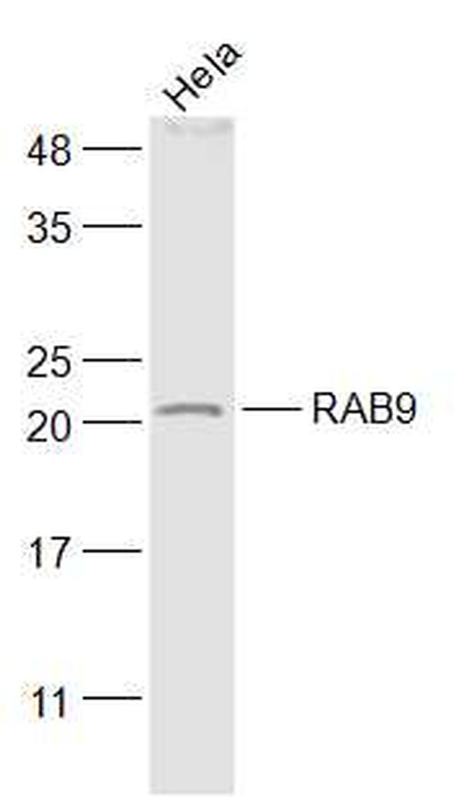 RAB9 Antibody in Western Blot (WB)