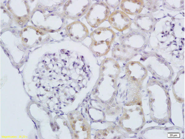 RAB20 Antibody in Immunohistochemistry (Paraffin) (IHC (P))