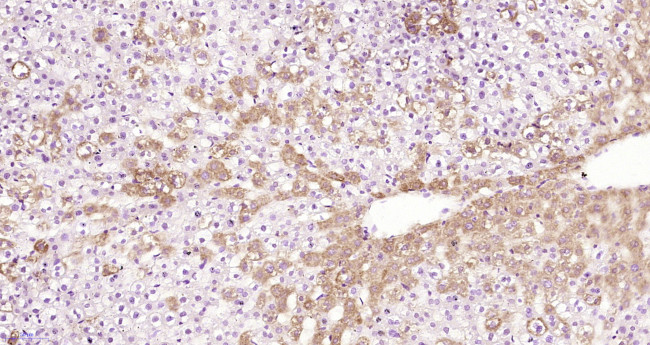 Alpha 2 antiplasmin Antibody in Immunohistochemistry (Paraffin) (IHC (P))