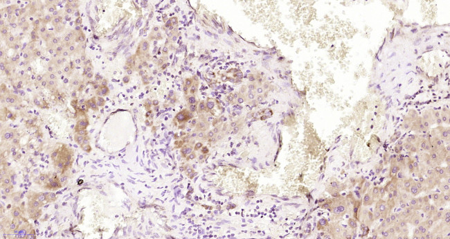 Alpha 2 antiplasmin Antibody in Immunohistochemistry (Paraffin) (IHC (P))