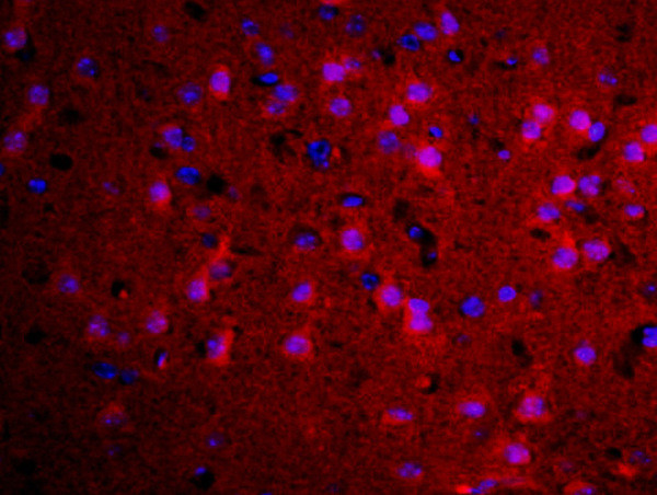 TGM2 Antibody in Immunohistochemistry (Paraffin) (IHC (P))