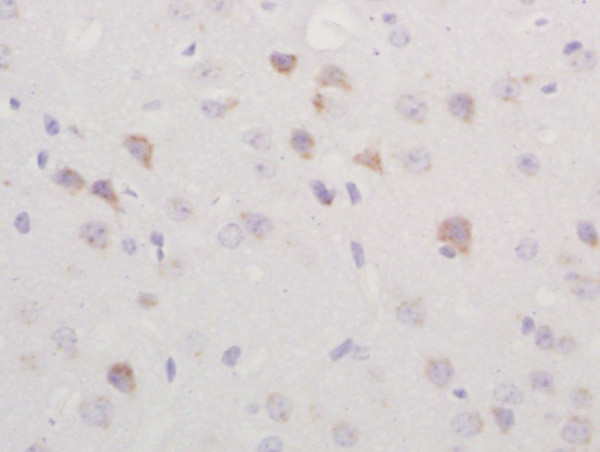 TGM2 Antibody in Immunohistochemistry (Paraffin) (IHC (P))