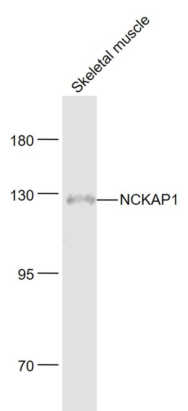 NCKAP1 Antibody in Western Blot (WB)