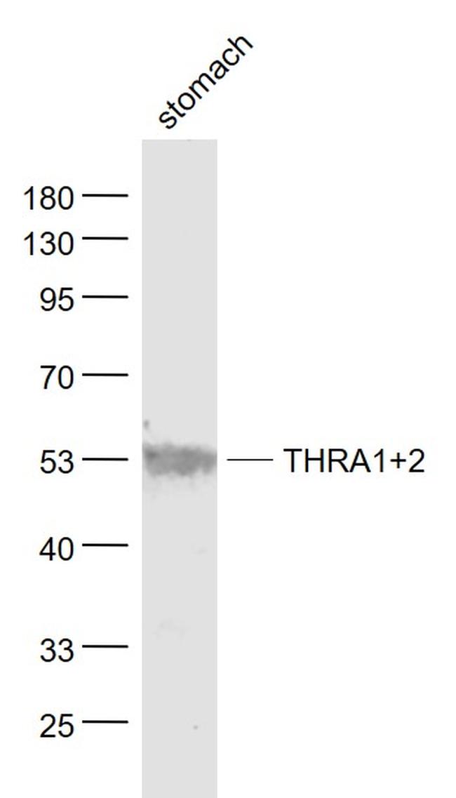 THRA1/2 Antibody in Western Blot (WB)