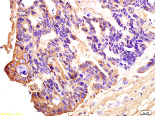 CT13 Antibody in Immunohistochemistry (Paraffin) (IHC (P))