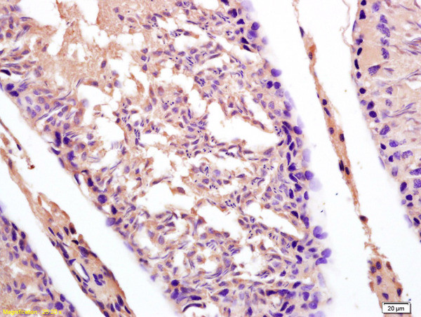 CT13 Antibody in Immunohistochemistry (Paraffin) (IHC (P))