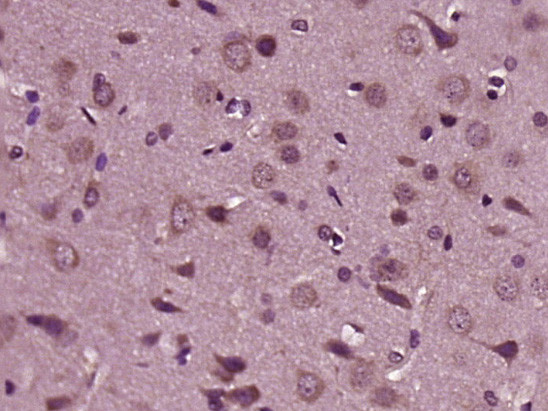 HRG beta 1 Antibody in Immunohistochemistry (Paraffin) (IHC (P))