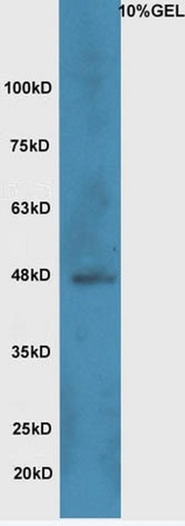 Wnt8b Antibody in Western Blot (WB)