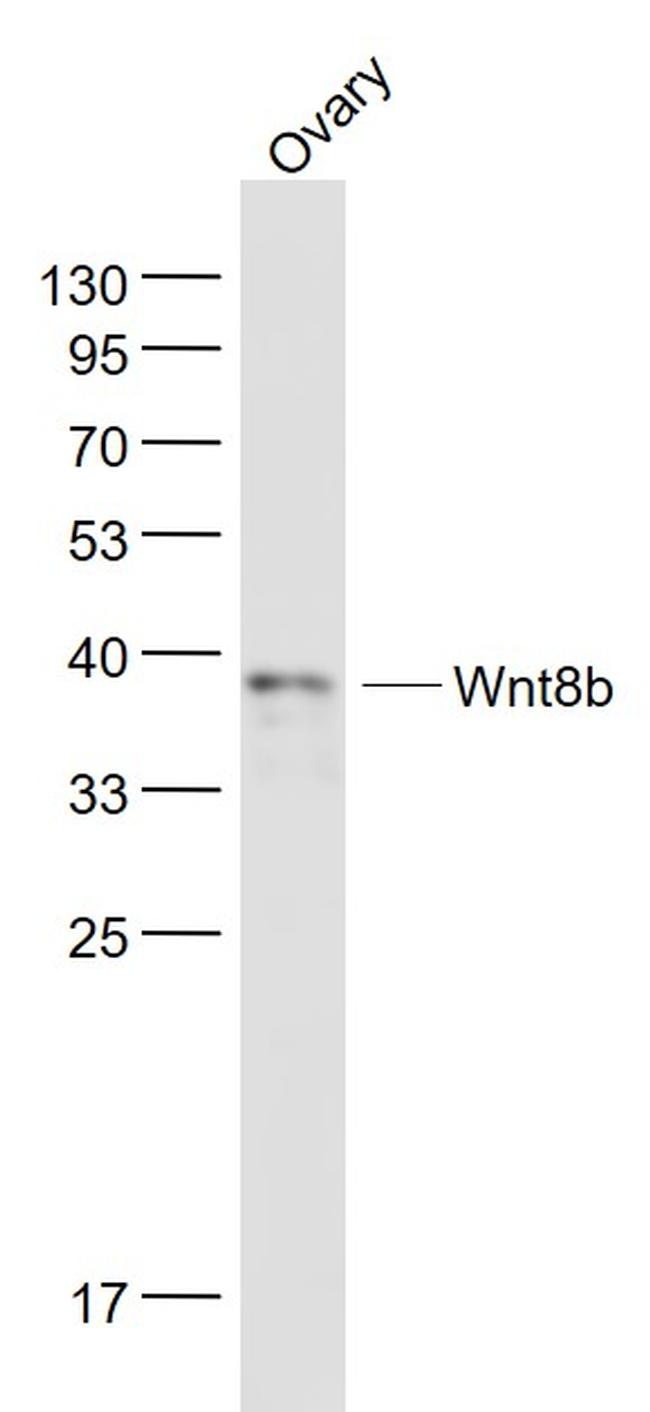 Wnt8b Antibody in Western Blot (WB)