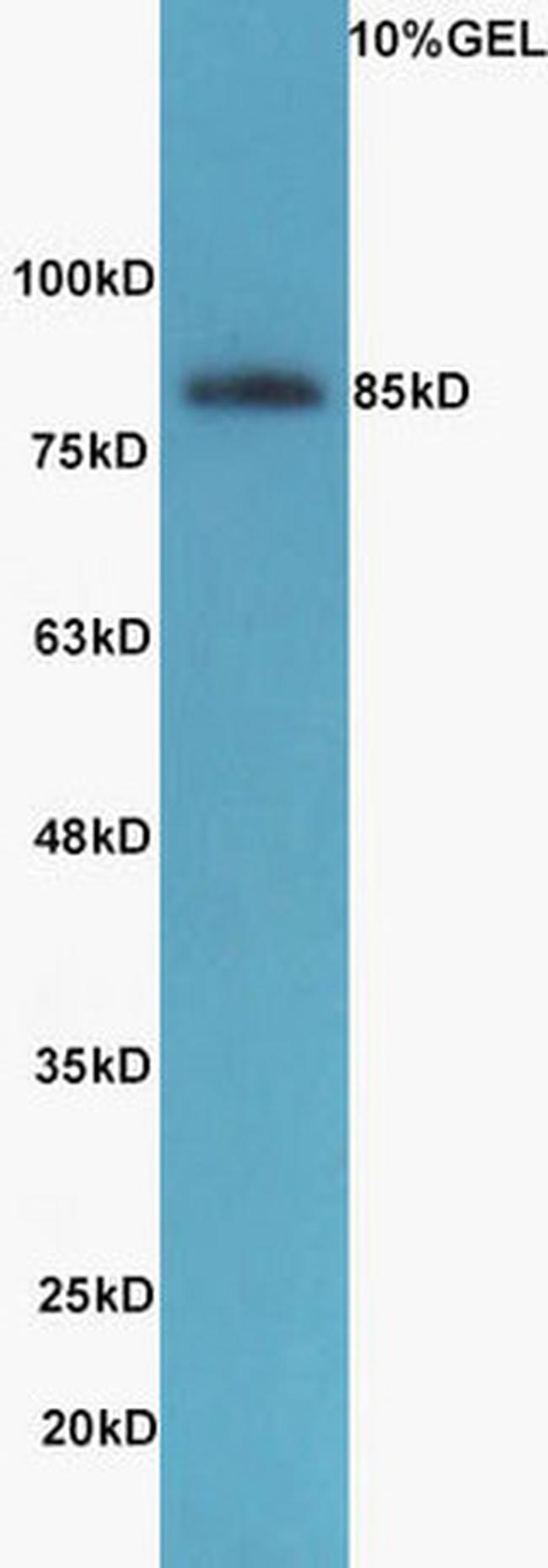 SIK1 Antibody in Western Blot (WB)