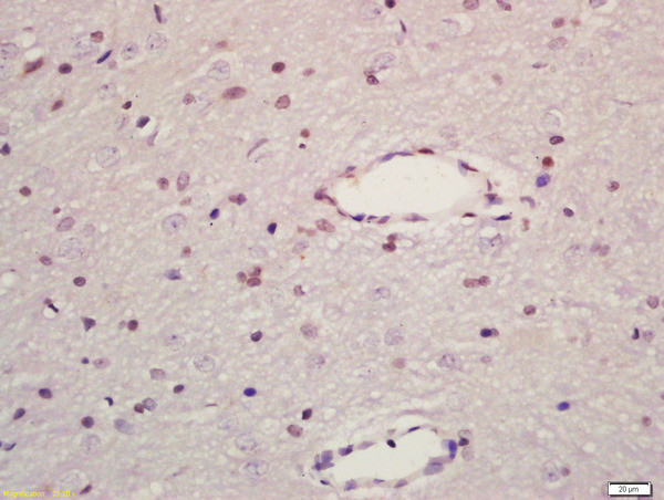 MAPK8IP1 Antibody in Immunohistochemistry (Paraffin) (IHC (P))