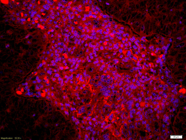 Dyrk1B Antibody in Immunohistochemistry (Paraffin) (IHC (P))