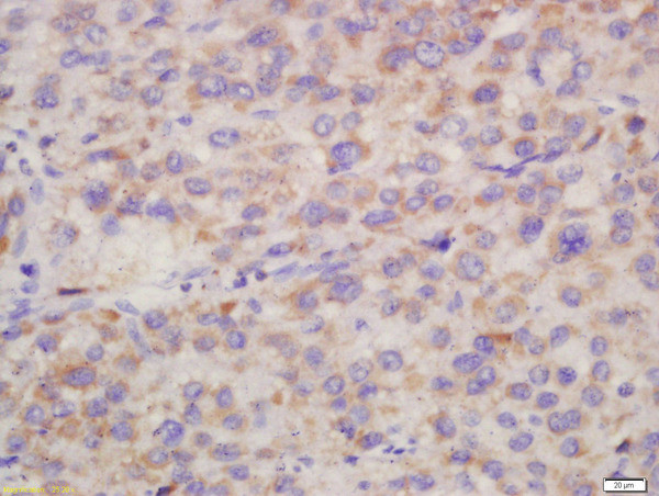 Hepsin Antibody in Immunohistochemistry (Paraffin) (IHC (P))