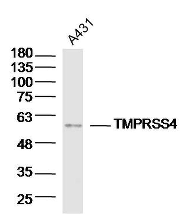 TMPRSS4 Antibody in Western Blot (WB)