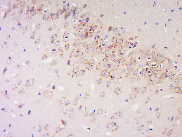 IFN-Alpha Antibody in Immunohistochemistry (Paraffin) (IHC (P))