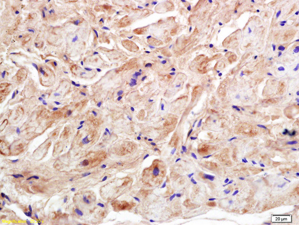 Ryanodine Receptor Antibody in Immunohistochemistry (Paraffin) (IHC (P))