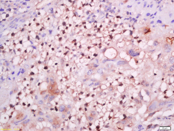 GCMA Antibody in Immunohistochemistry (Paraffin) (IHC (P))