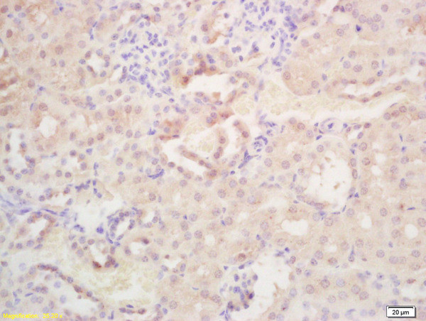 WISP1 Antibody in Immunohistochemistry (Paraffin) (IHC (P))