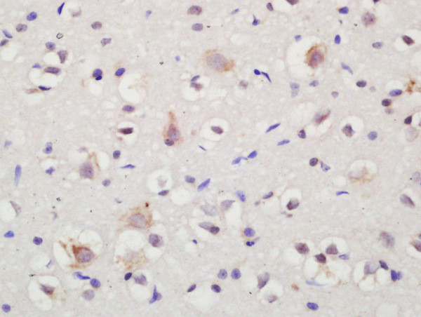 Sortilin Antibody in Immunohistochemistry (Paraffin) (IHC (P))