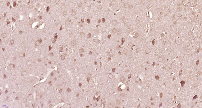 Nerve growth factor inducible Antibody in Immunohistochemistry (Paraffin) (IHC (P))