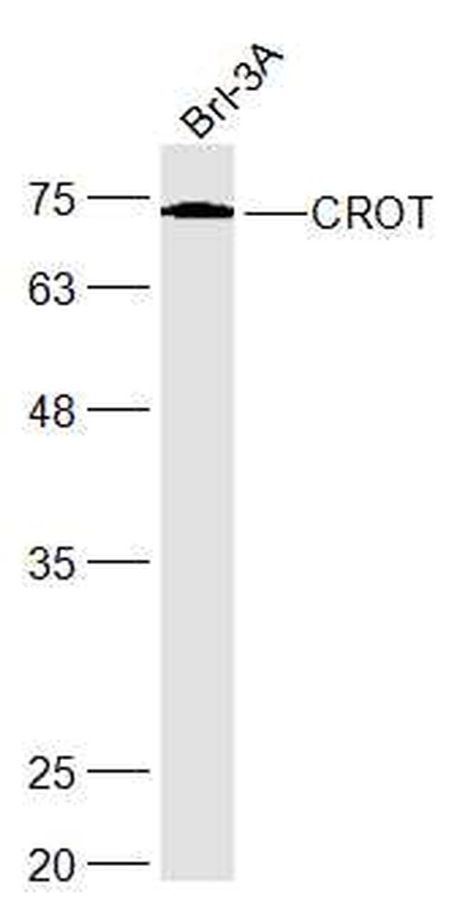 CROT Antibody in Western Blot (WB)