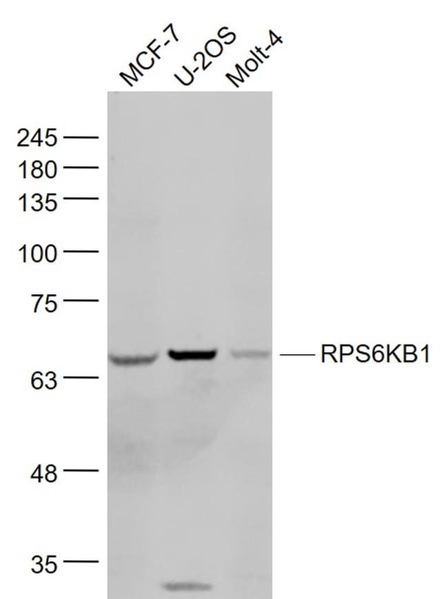 p70 S6 kinase alpha Antibody in Western Blot (WB)