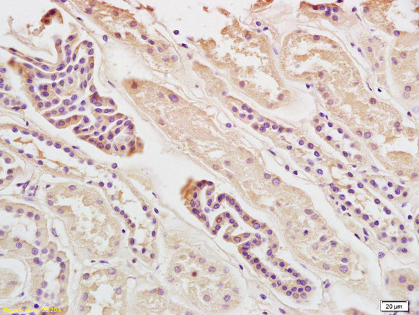 Ferritin Light Chain Antibody in Immunohistochemistry (Paraffin) (IHC (P))