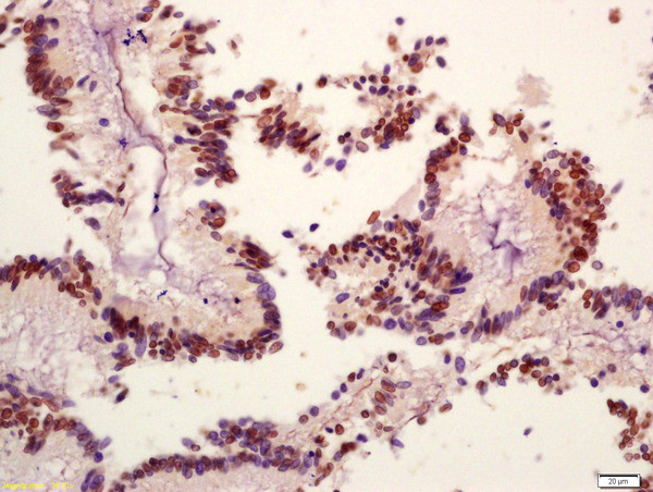 Phospho-PI3 Kinase p110 beta (Ser1070) Antibody in Immunohistochemistry (Paraffin) (IHC (P))