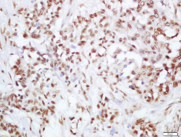 Phospho-PI3 Kinase p110 beta (Ser1070) Antibody in Immunohistochemistry (Paraffin) (IHC (P))