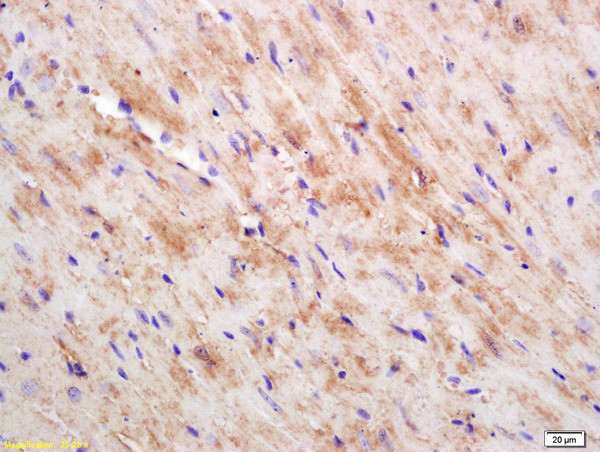 CKMT Antibody in Immunohistochemistry (Paraffin) (IHC (P))