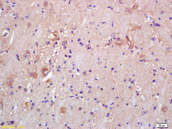 CKMT Antibody in Immunohistochemistry (Paraffin) (IHC (P))