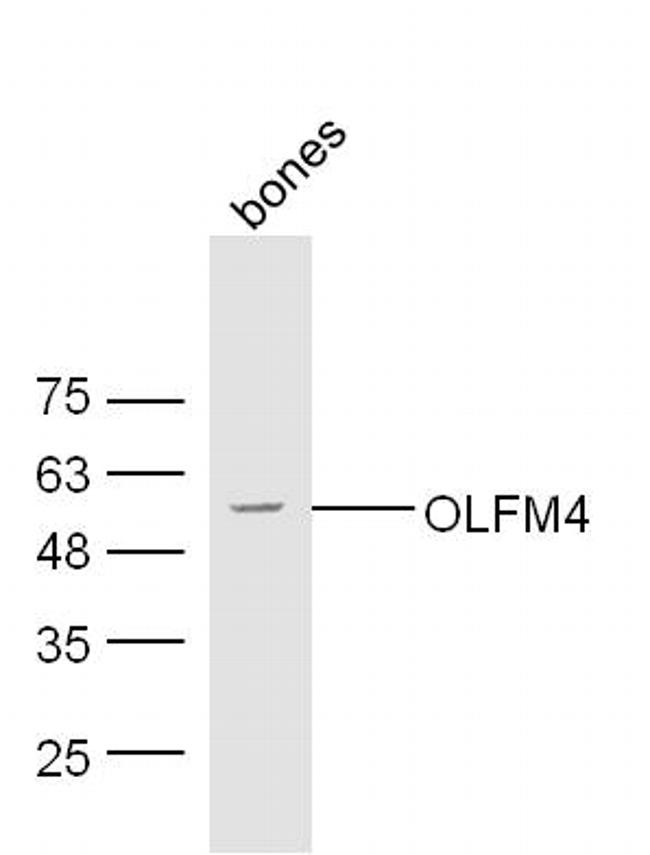 OLFM4 Antibody in Western Blot (WB)