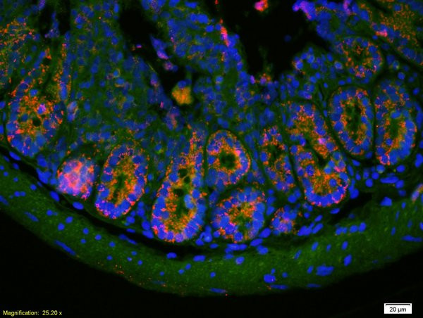 PAI1 Antibody in Immunohistochemistry (Paraffin) (IHC (P))