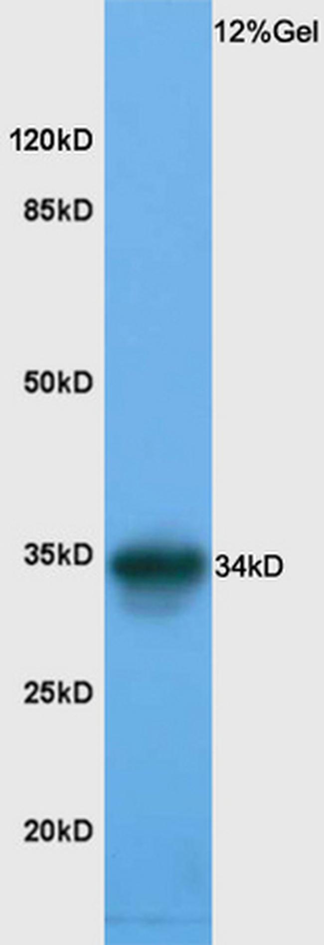 RPL5 Antibody in Western Blot (WB)