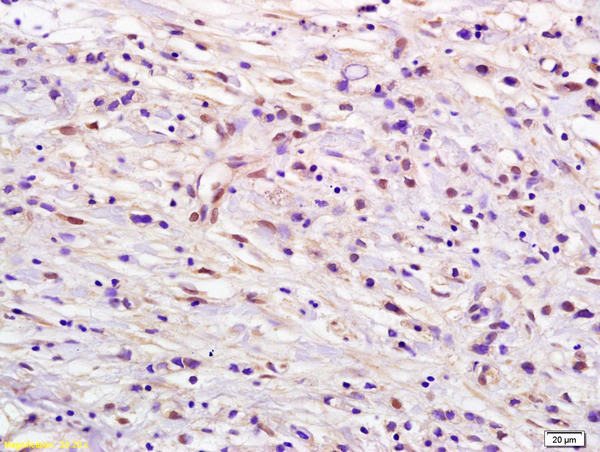 DUT Antibody in Immunohistochemistry (Paraffin) (IHC (P))