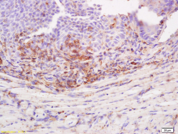 Desmoglein 3 Antibody in Immunohistochemistry (Paraffin) (IHC (P))