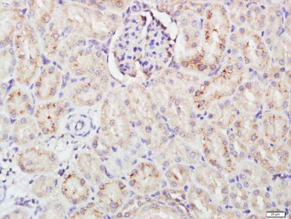 FCAR Antibody in Immunohistochemistry (Paraffin) (IHC (P))