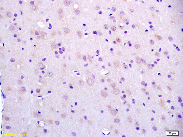 BCAT2 Antibody in Immunohistochemistry (Paraffin) (IHC (P))