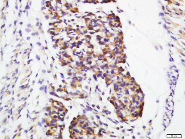 Galectin 1 Antibody in Immunohistochemistry (Paraffin) (IHC (P))