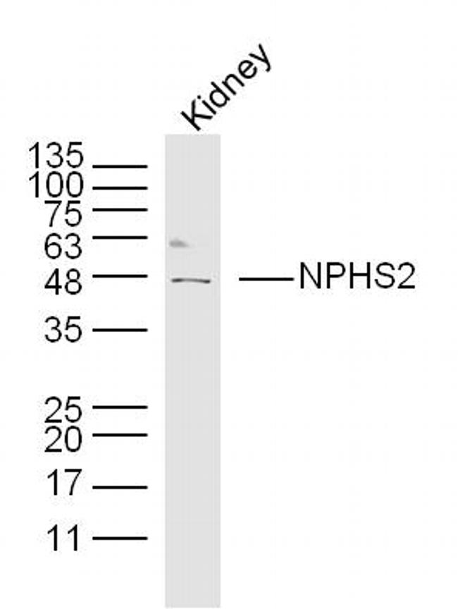 Podocin Antibody in Western Blot (WB)