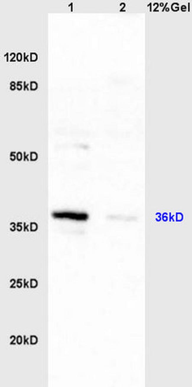 HSD17B1 Antibody in Western Blot (WB)