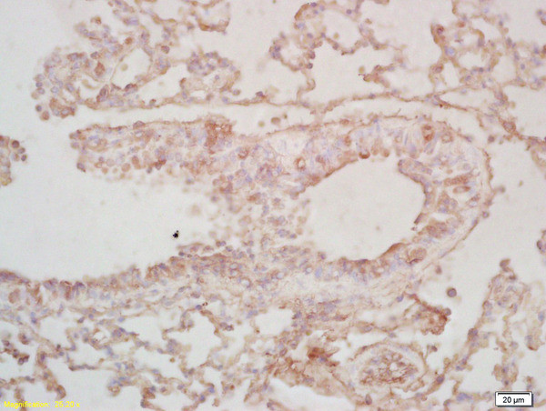 BCAS2 Antibody in Immunohistochemistry (Paraffin) (IHC (P))