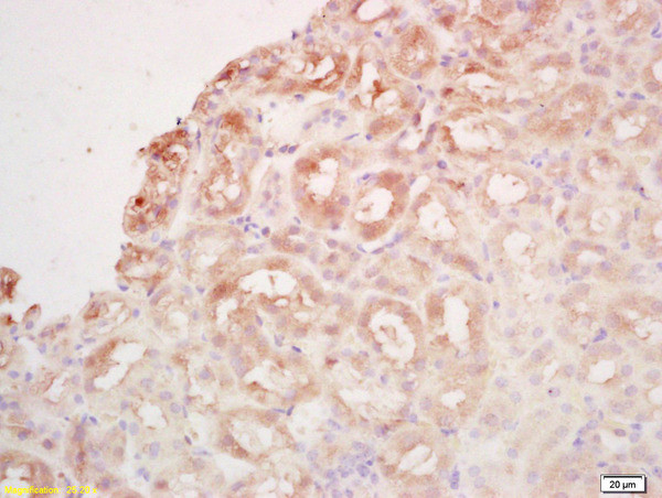 BCAS2 Antibody in Immunohistochemistry (Paraffin) (IHC (P))